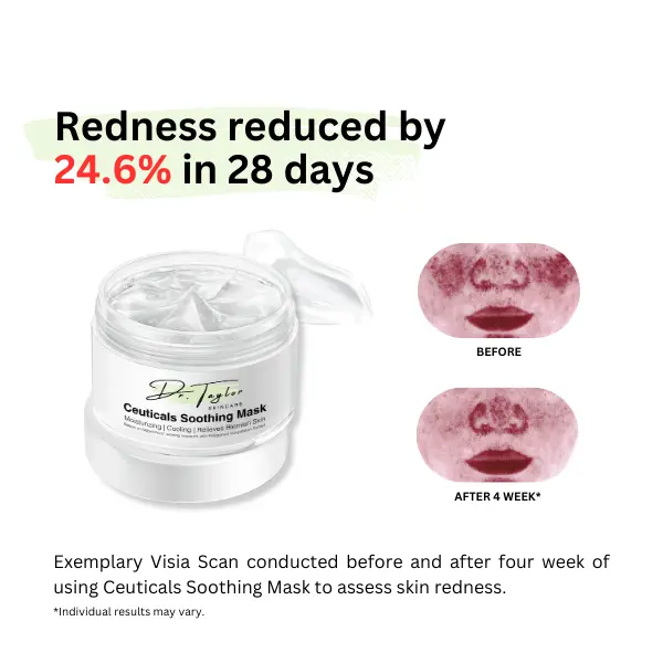 Dr. Taylor  Ceuticals Soothing Mask 100g, Skin Repair, blemish relief, Redness reduction, Sensitive-skin friendly 3