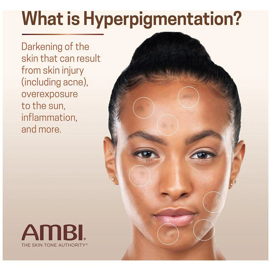 Ambi Even & Clear Fade Cream for All Skin Types 7