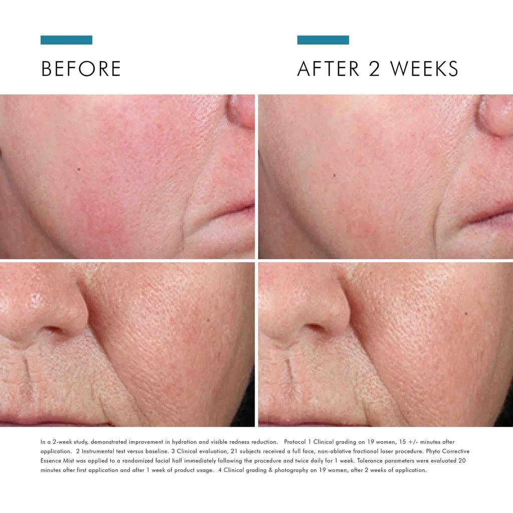 SkinCeuticals SkinCeuticals Phyto Corrective Essence Facial Mist 5