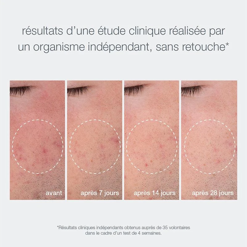 Dermalogica Coffret Ultra Clean, Ultra Smooth Duo | Coffret Duo Nettoyant Et Exfoliant 6