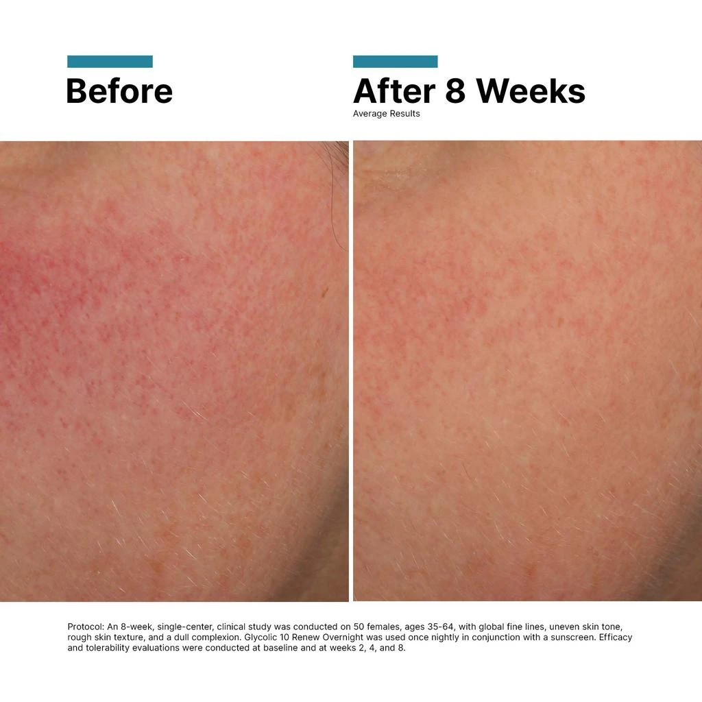SkinCeuticals SkinCeuticals Glycolic 10 Renew Overnight 6