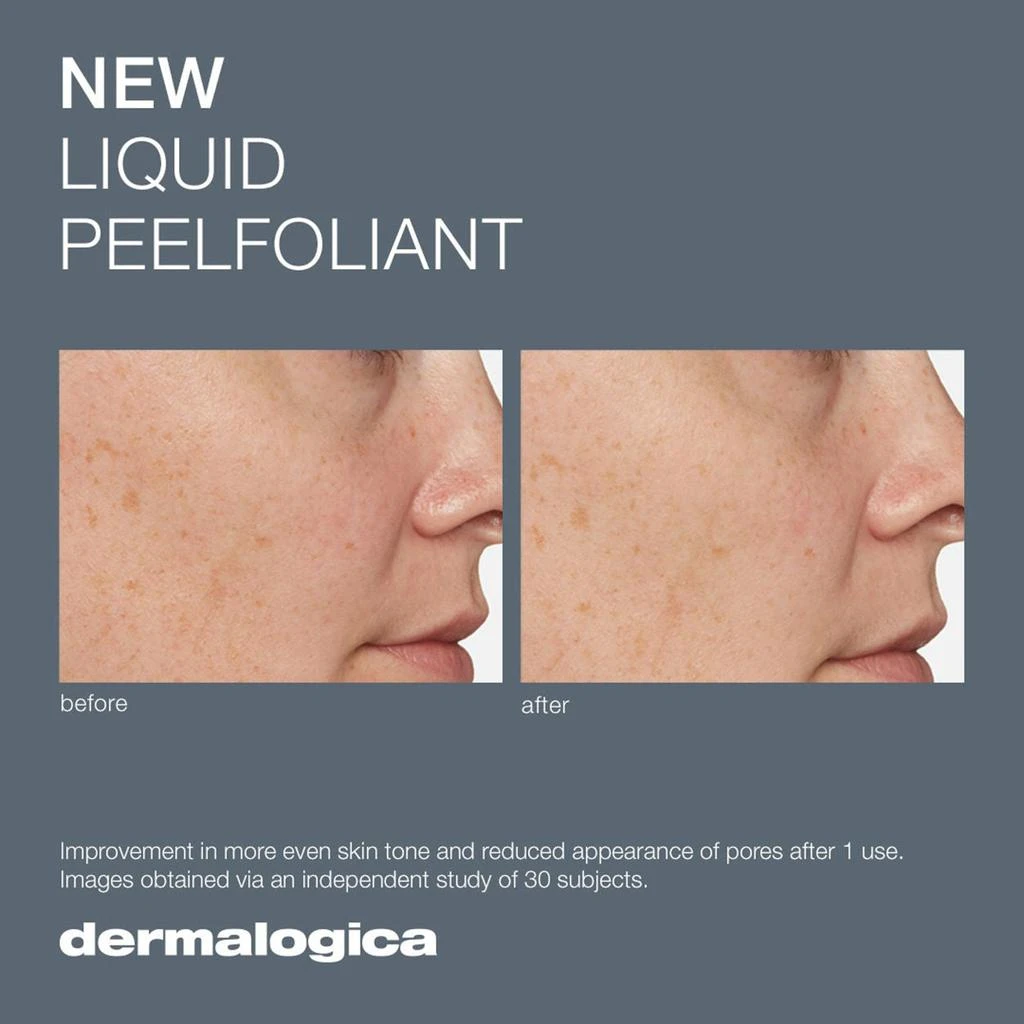Dermalogica Liquid Peelfoliant 4
