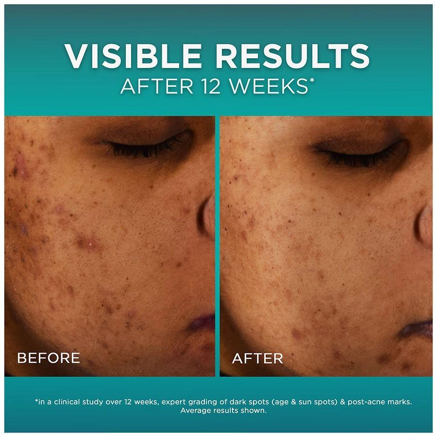 L
Oreal Paris Bright Reveal 12% Niacinamide + Amino Sulfonic + Ferulic Acid Dark Spot Serum 5