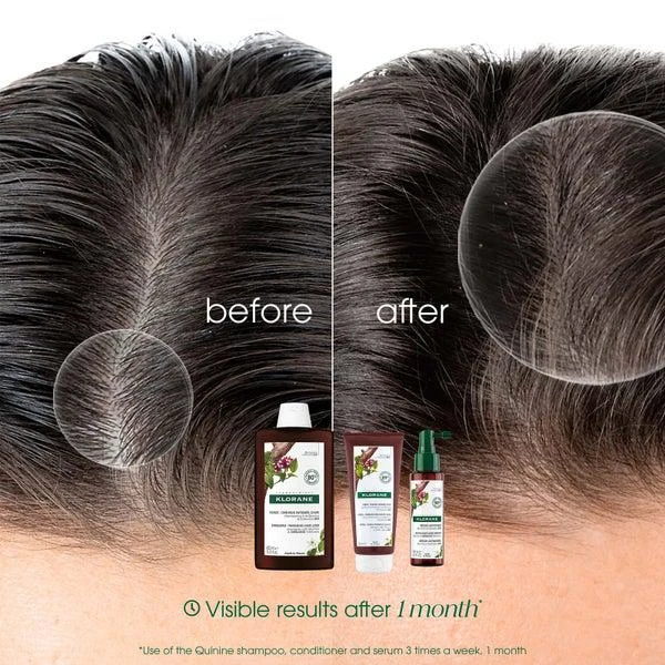 KLORANE KLORANE Conditioner for Thinning, Tired Hair with Quinine and ORGANIC Edelweiss 200ml 4