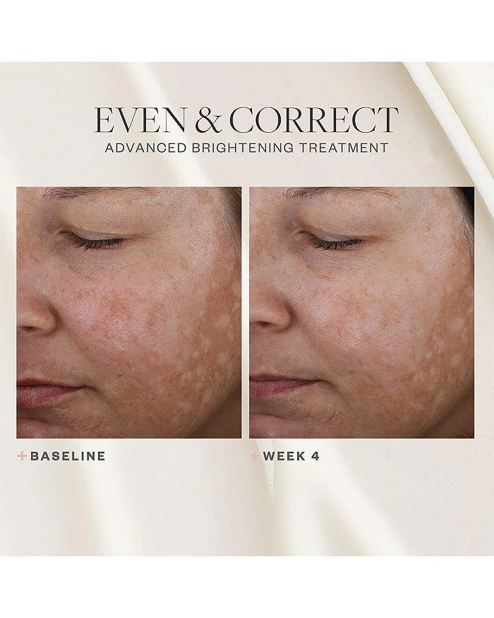 SkinMedica Even & Correct Advanced Brightening Treatment 2 oz. 10