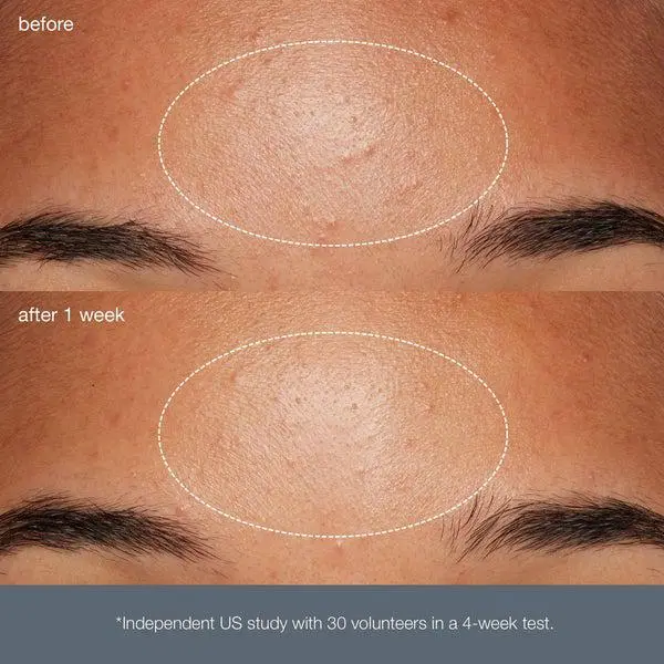 Dermalogica Dermalogica Daily Microfoliant Refill 4