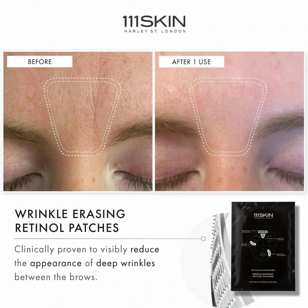 111SKIN 111SKIN Wrinkle Erasing Retinol Patches 4