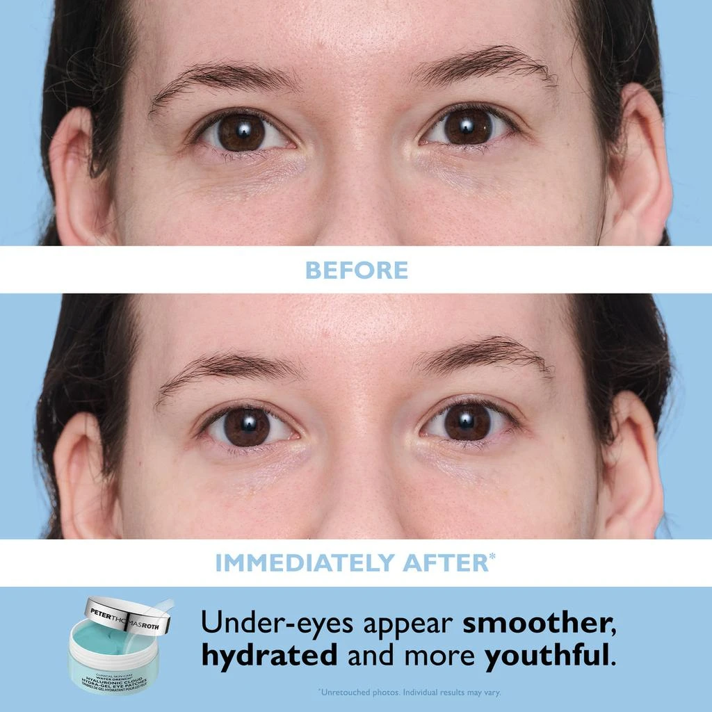 Peter Thomas Roth Full-Size Vitamin C & Hyaluronic Eye Patches 2-Piece Kit 5