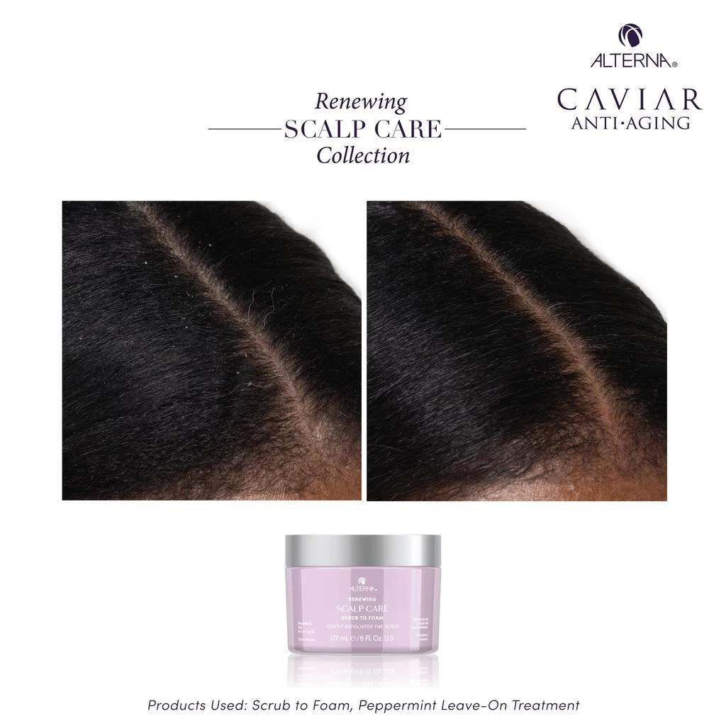ALTERNA Alterna Renewing Scalp Care Scrub-to-Foam 6 oz 5