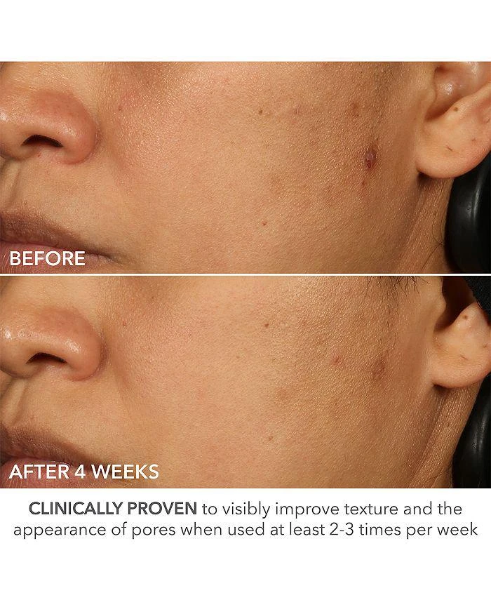 Dr. Dennis Gross Advanced Retinol + Ferulic Perfectly Dosed Retinol Peel (Extra Strength 0.5% Pure Retinol), Set of 8 10