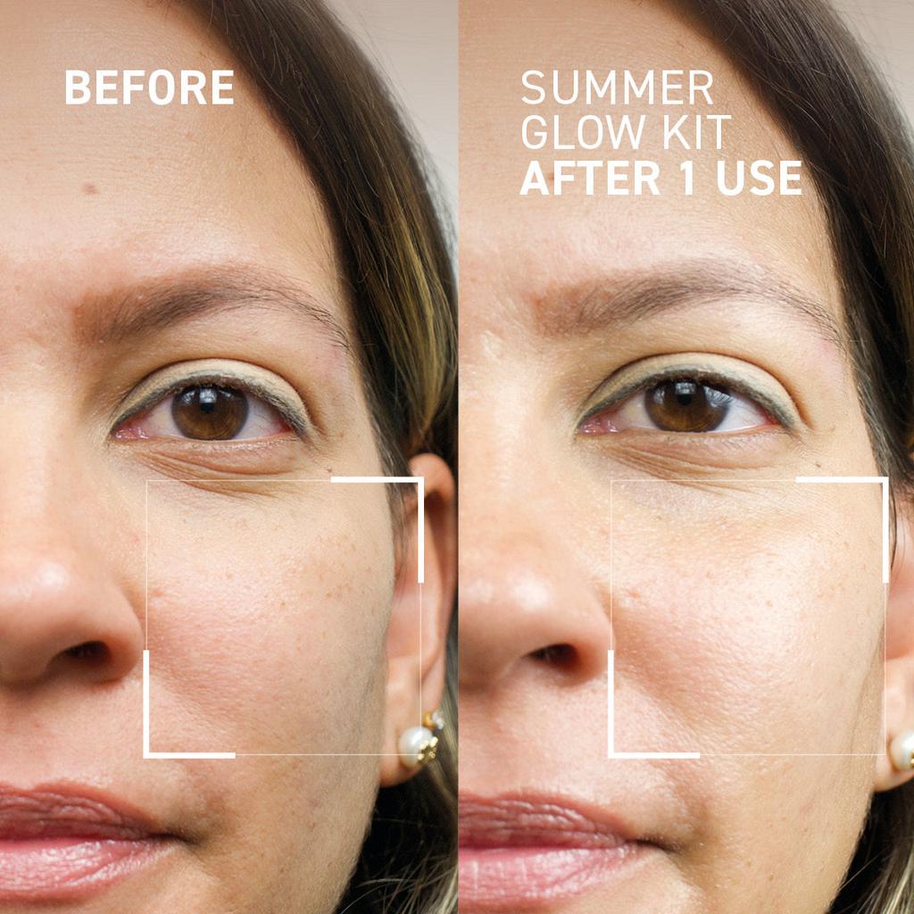 Dr. Brandt Skincare SUMMER GLOW KIT