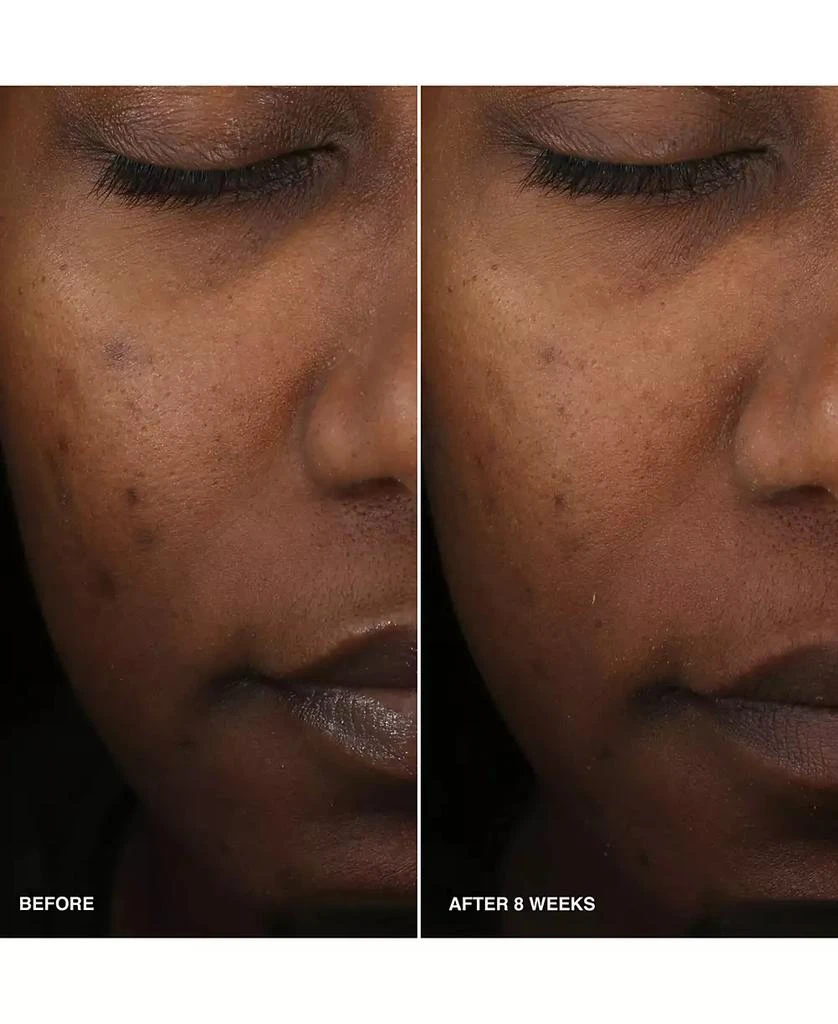 Bobbi Brown Vitamin Enriched Smoothing Niacinamide + Vitamin C Serum, 1 oz. 5