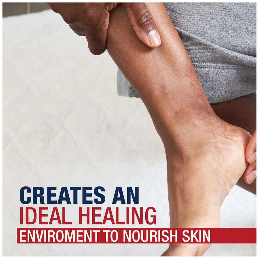 Aquaphor Advanced Therapy Healing Ointment Skin Protectant 8