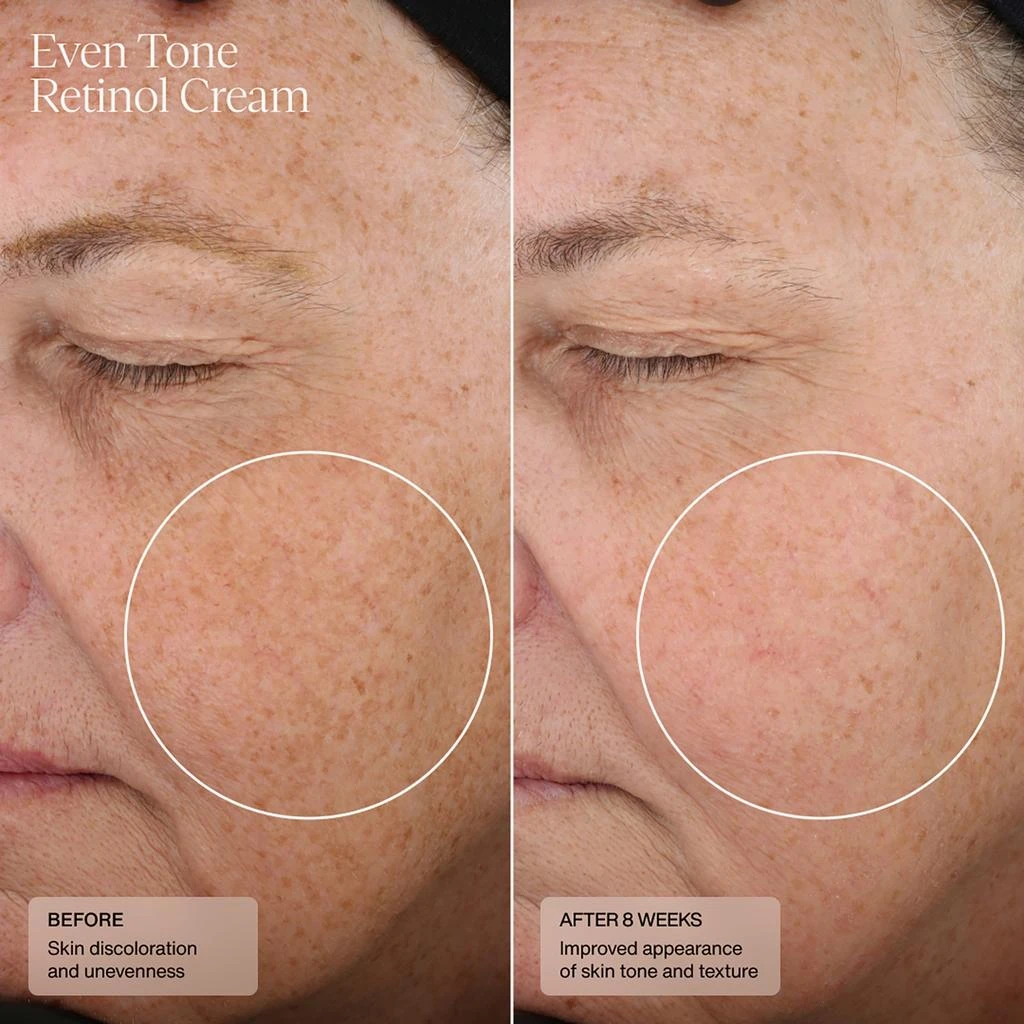 SENTÉ SENTÉ Even Tone Retinol Cream 30ml 3