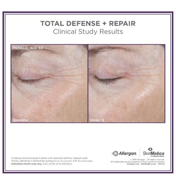 SkinMedica SkinMedica Total Defense and Repair SPF 34 - Tinted (2.3oz) 4