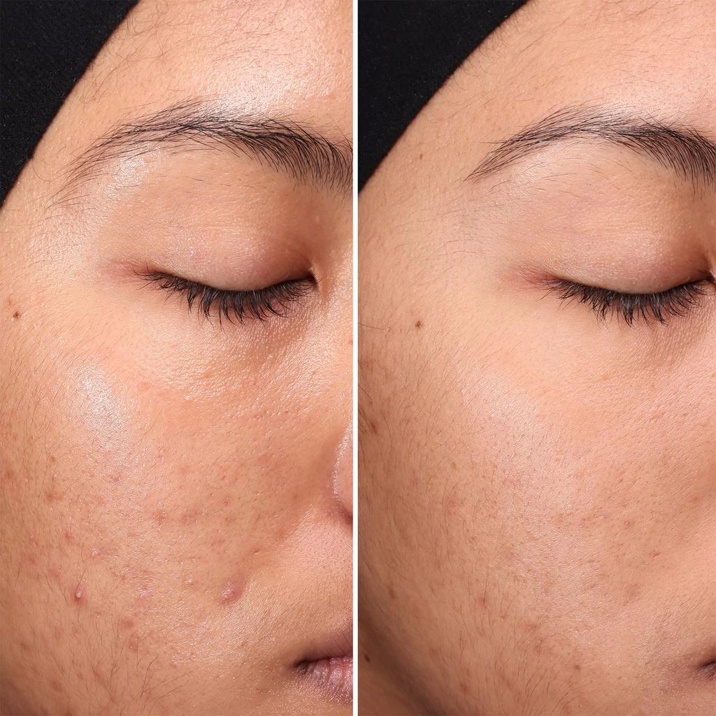 Medik8 Medik8 Press and Clear 150ml 6