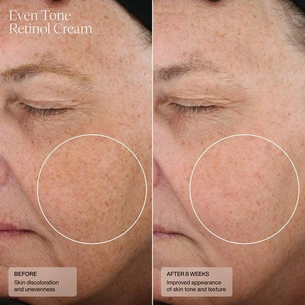 SENTÉ SENTÉ Even Tone Retinol Cream 30ml 3
