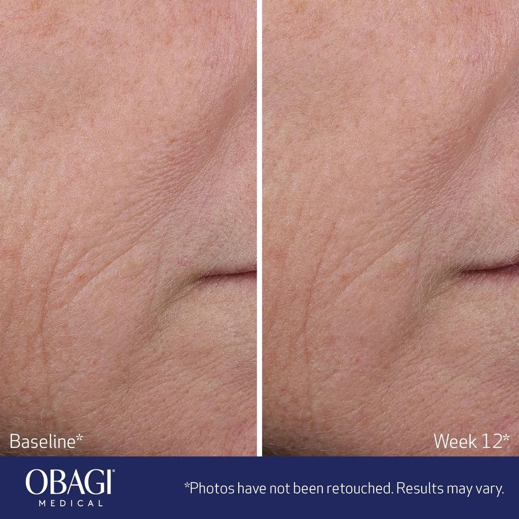 Obagi Medical Obagi Medical ELASTIderm Advanced Filler Concentrate 7