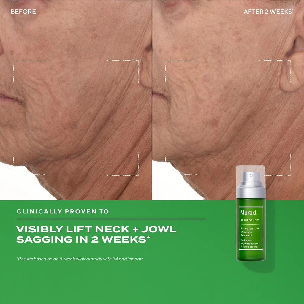 Murad Murad Retinal ReSculpt Overnight Treatment 1 oz 3