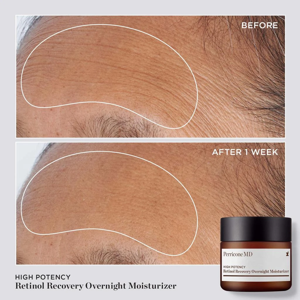Perricone MD High Potency Retinol Recovery Overnight Moisturizer 5