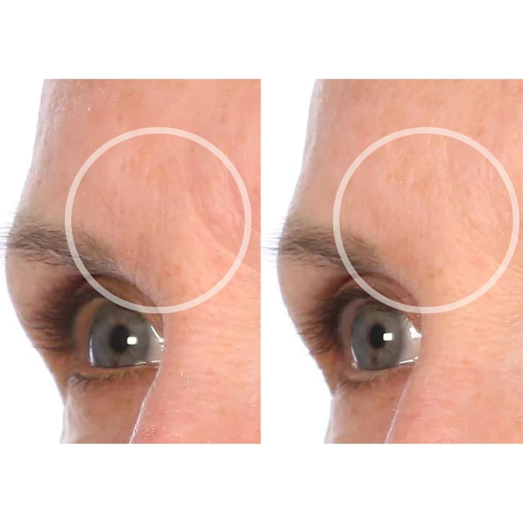 SIO Beauty SiO Beauty Browlift Patch 3