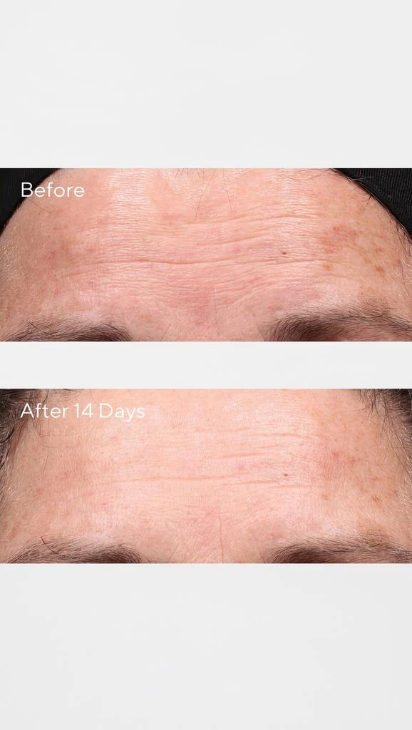 Murad Retinol Youth Renewal Serum 3