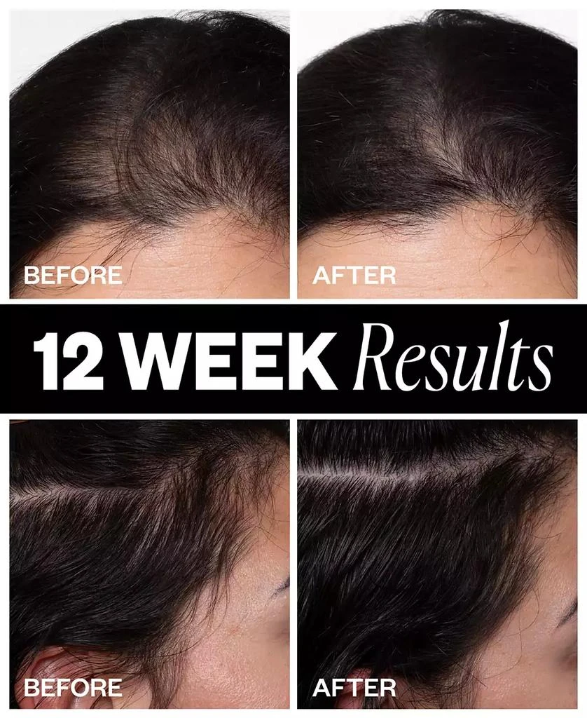 IGK Hair Sponsored Hair Density Scalp Treatment, 2.1 oz. 6