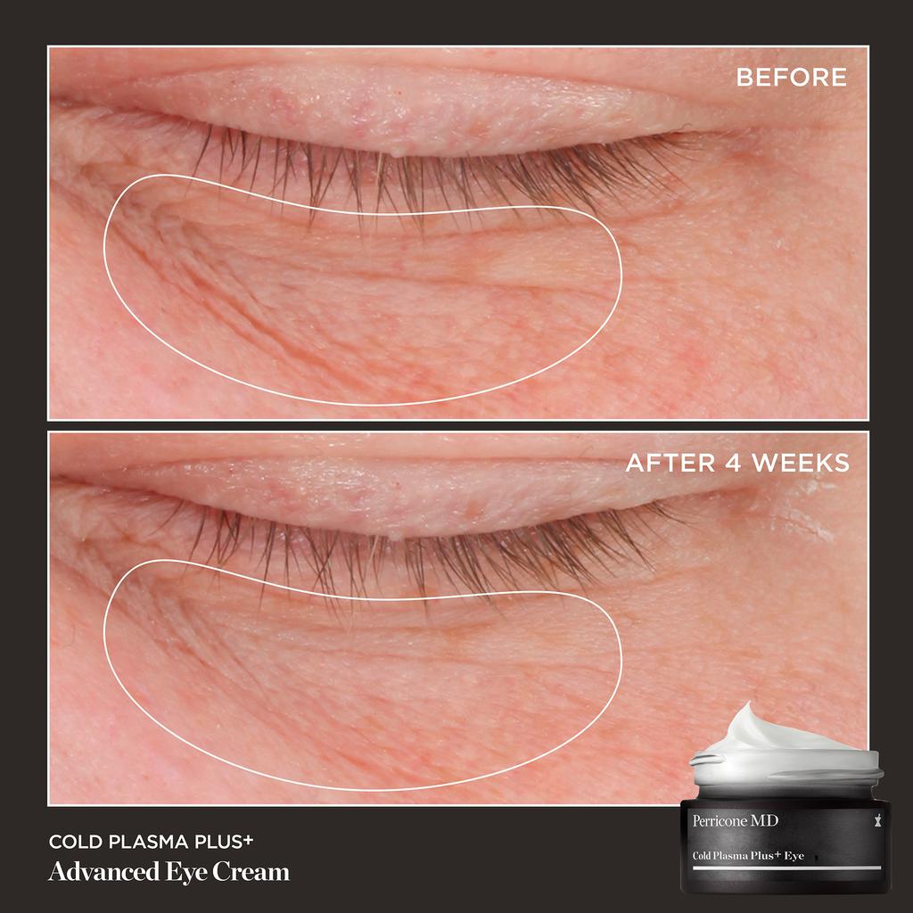 Perricone MD Cold Plasma Plus+ Advanced Eye Cream