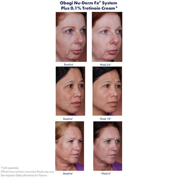 Obagi Obagi Medical Nu-Derm Toner (6.7 oz.) 2