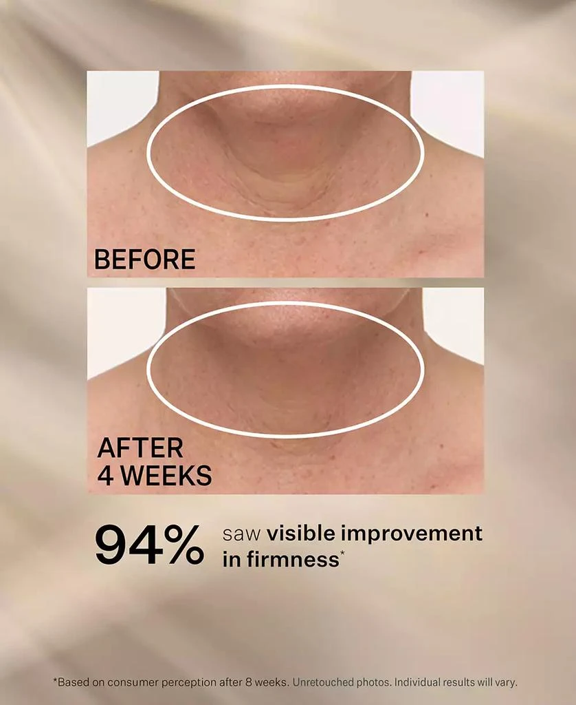 StriVectin TL Advanced Tightening Neck Cream Plus With Alpha-3 Peptide, 3.4 oz. 6