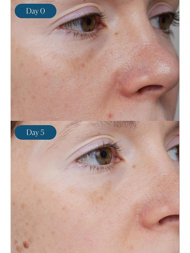 ELEMIS Dynamic Resurfacing Super-C Serum 7