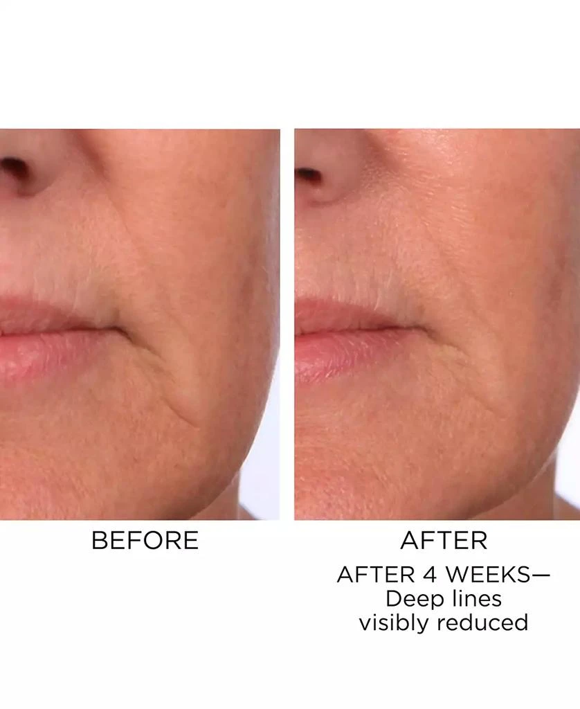 Elizabeth Arden 4-Pc. Prevage Progressive Renewal Treatment Set 5