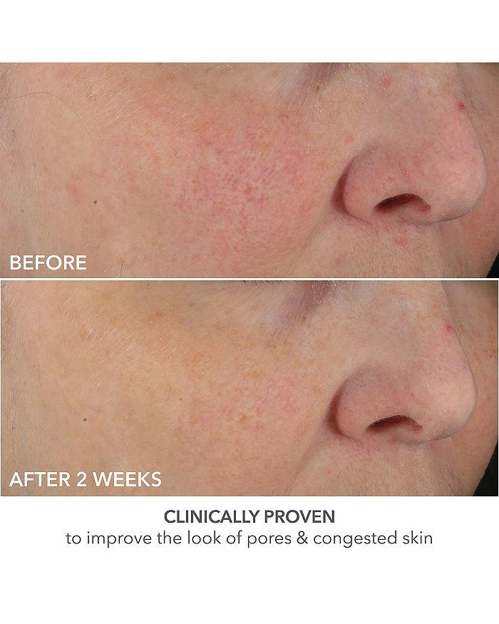 Dr. Dennis Gross Advanced Retinol + Ferulic Perfectly Dosed Retinol Peel (Universal 0.2% Pure Retinol), Set of 8 11