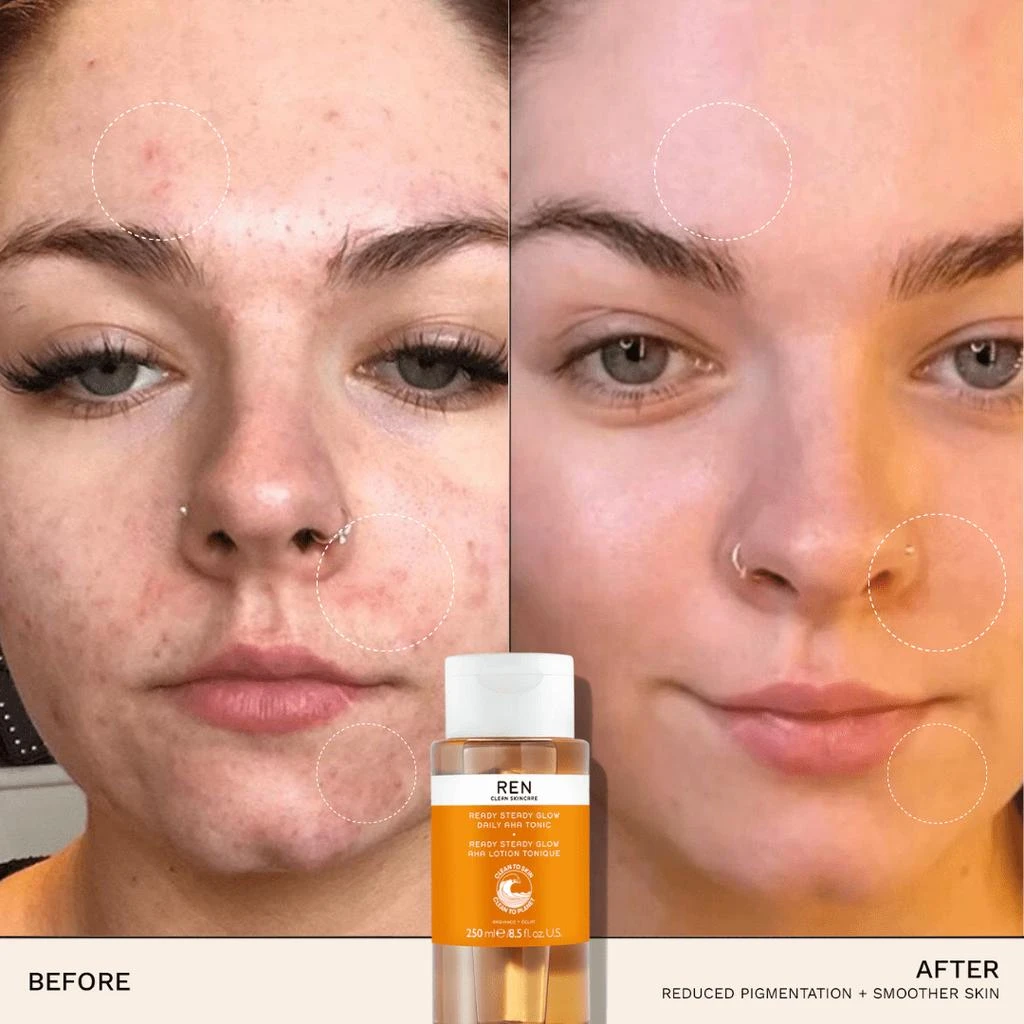 REN Clean Skincare Radiance Ready Steady Glow Daily AHA Tonic 4