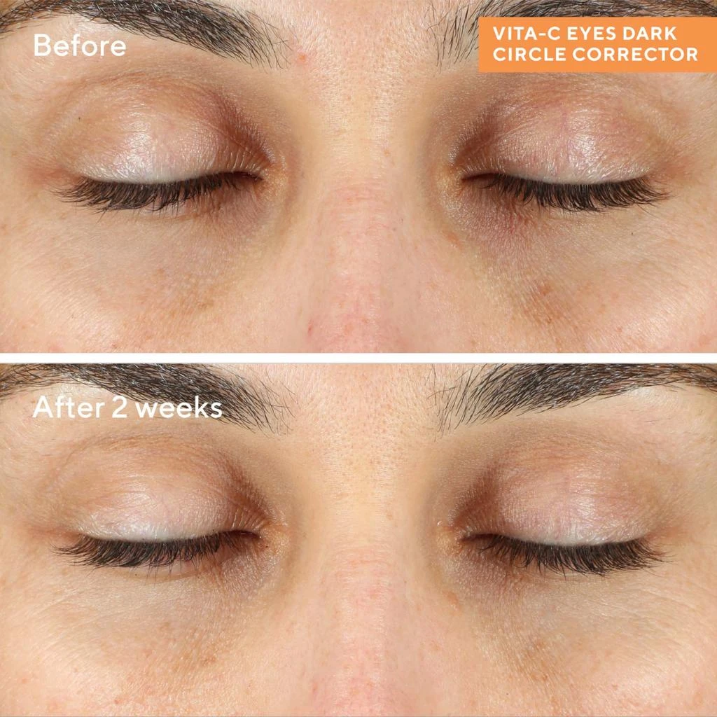 Murad Murad Vita-C Eyes Dark Circle Corrector 0.5 oz 3