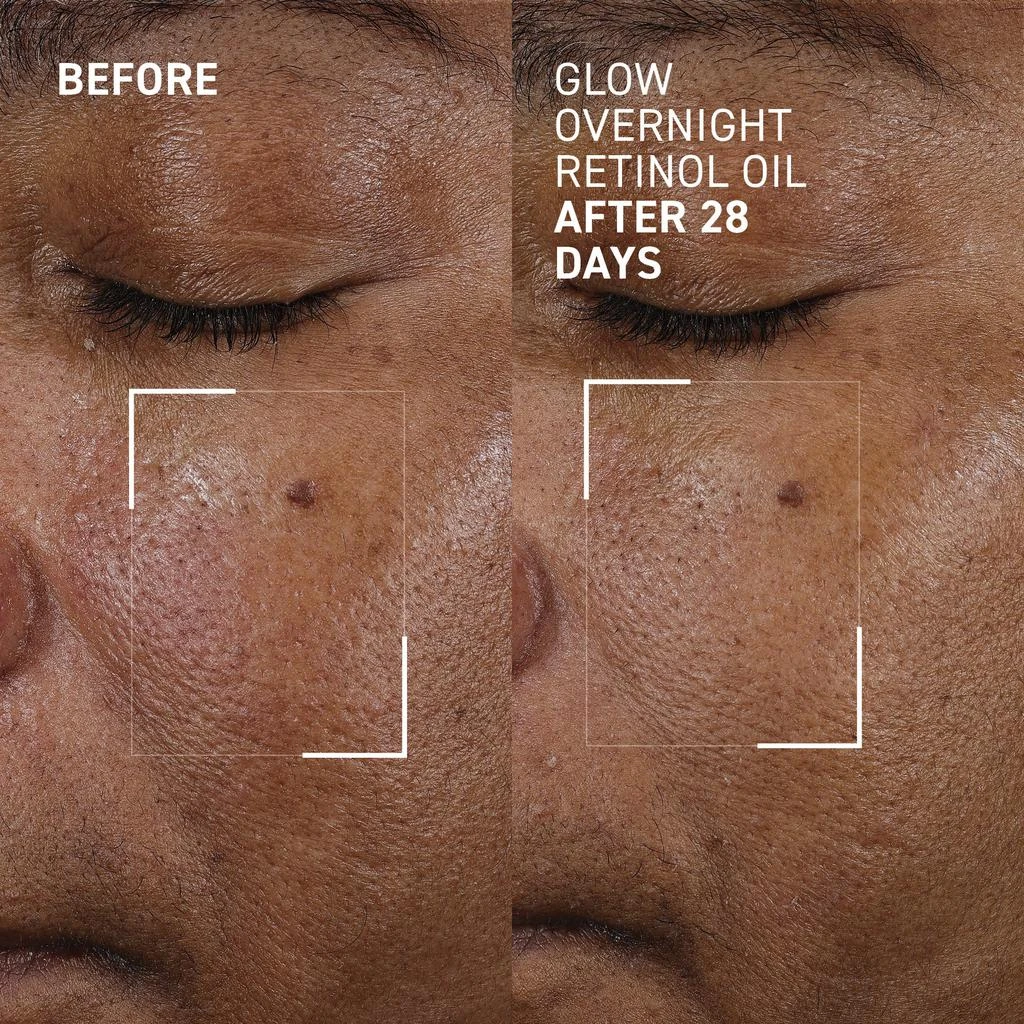 Dr. Brandt GLOW OVERNIGHT RETINOL OIL™ 3