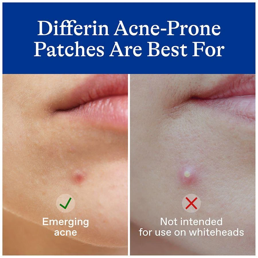 Differin Acne-Prone Skin Patches Fragrance Free 3