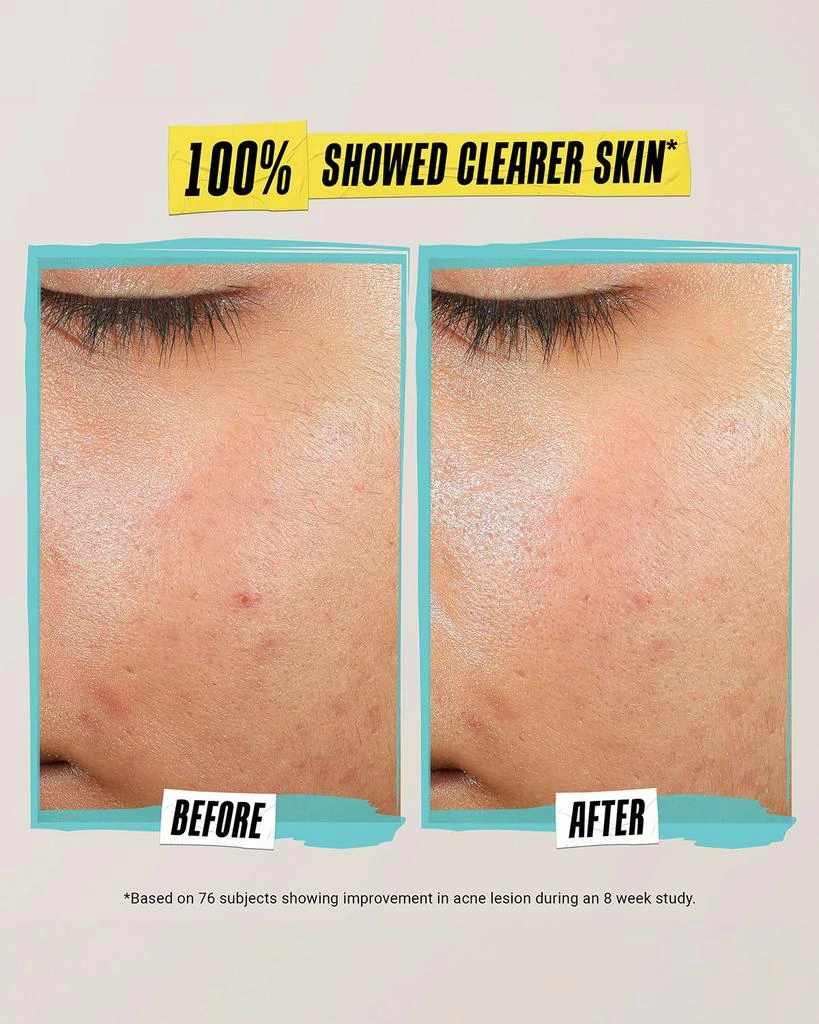 Kiehl's Expertly Clear Acne Treating & Preventing Lotion, 2 oz. 2