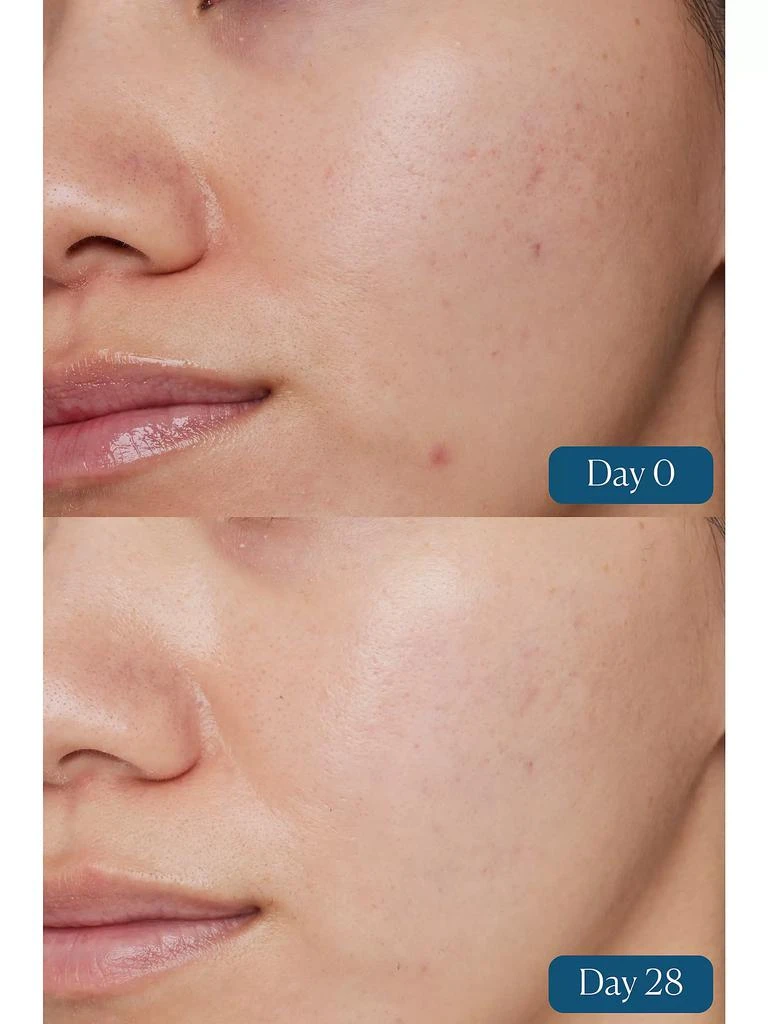 ELEMIS Dynamic Resurfacing Super-C Serum 4