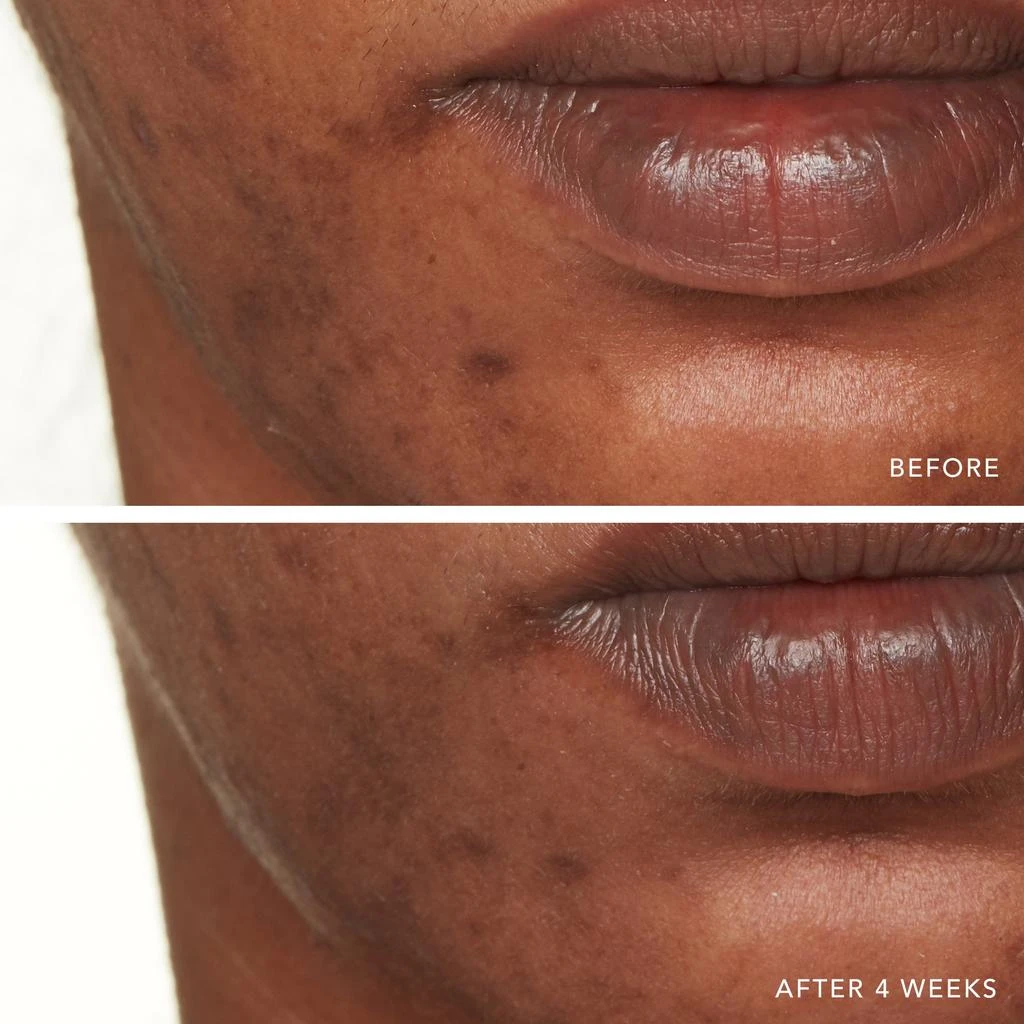 Lancer Skincare Lancer Skincare Advanced C Radiance Treatment with Vitamin C Collagen with Vitamin C Collagen Cofactor 10x 6