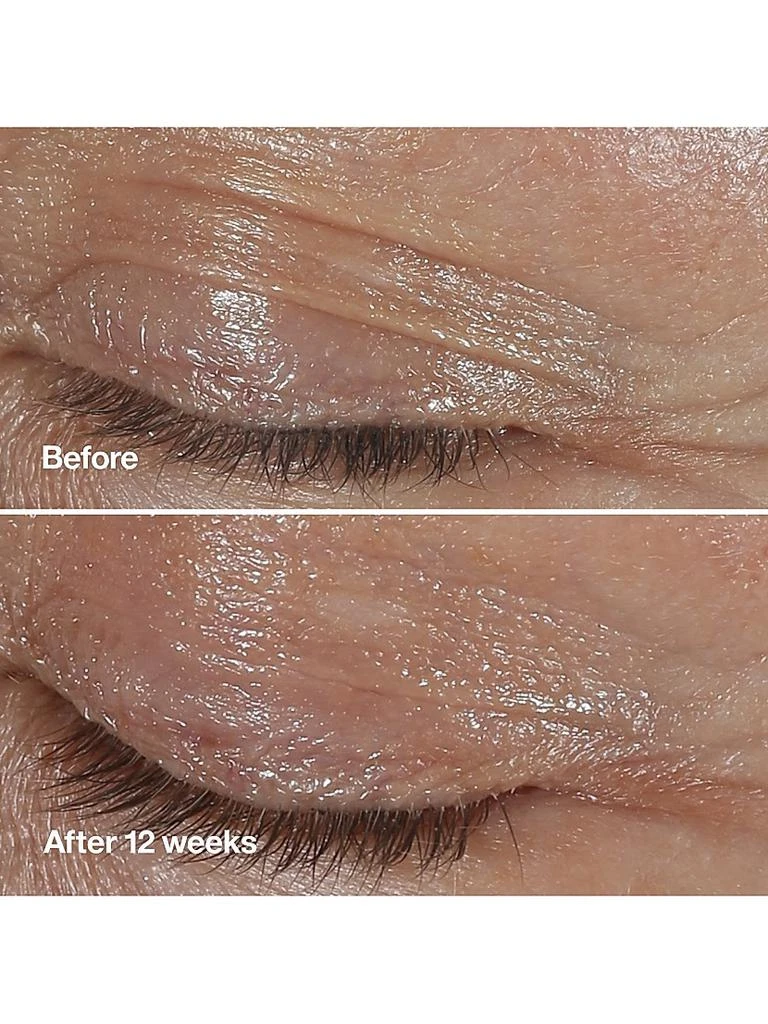 Clinique Clinique Smart Clinical Repair Wrinkle Correcting Eye Cream 10