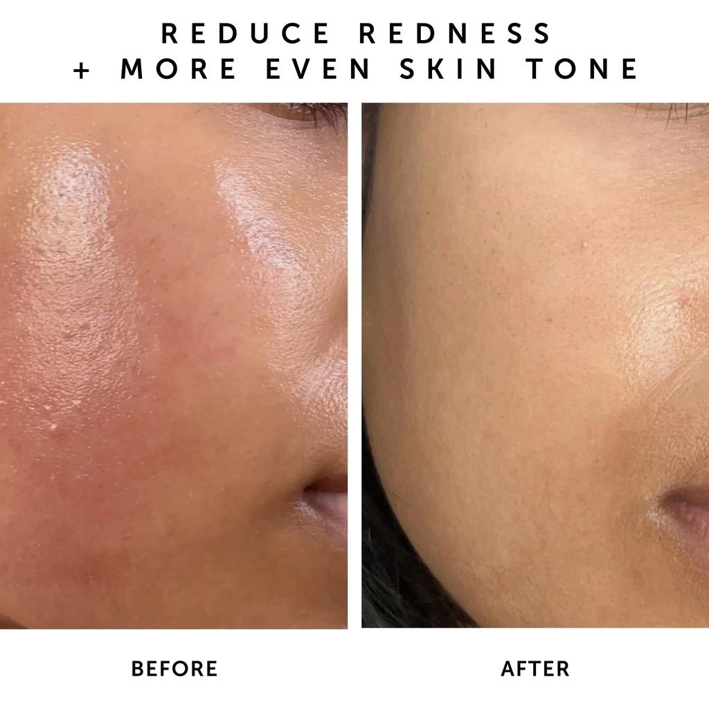 Herbivore Botanicals Herbivore Botanicals Nova 15% Vitamin C and Turmeric Brightening Serum 30ml 5