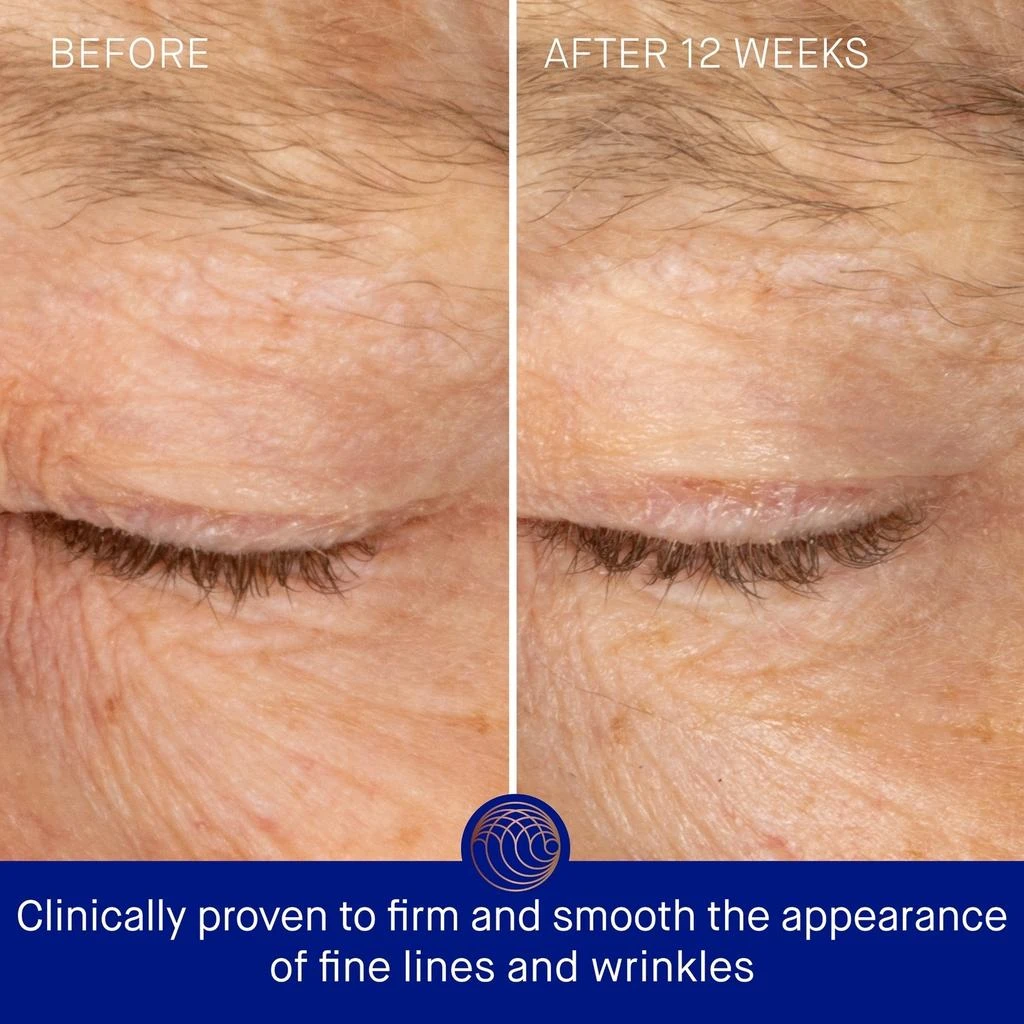 Augustinus Bader Augustinus Bader The Rich Eye Cream 15ml 5