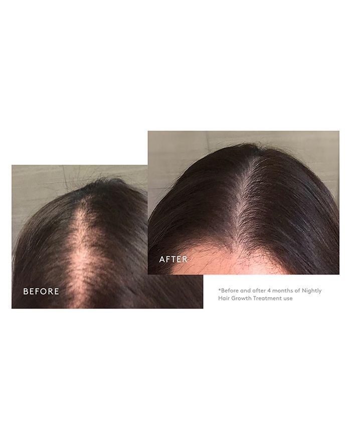 Virtue Flourish Nightly Intensive Hair Growth Treatment - 90 Days