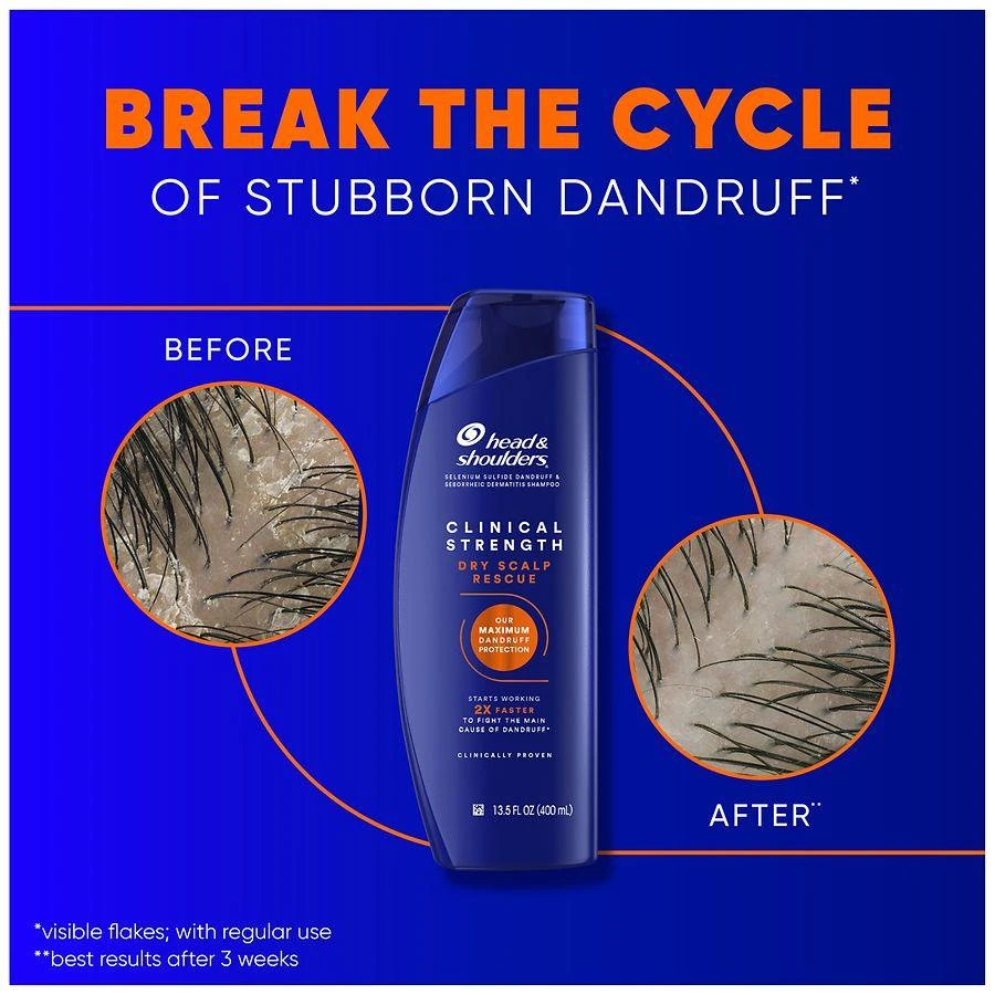 Head & Shoulders Clinical Strength Dry Scalp Rescue Shampoo, for Stubborn Dandruff 7