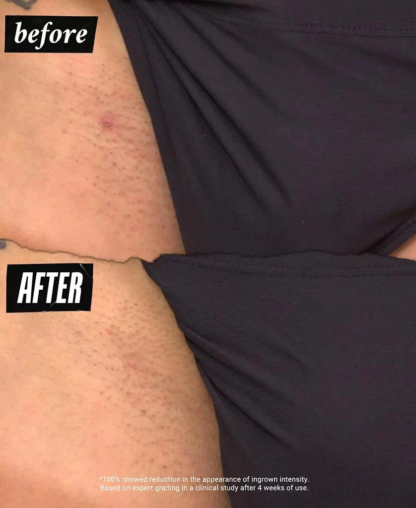 Kiehl's Ingrown Hair & Tone-Correcting Intimate Drops 8
