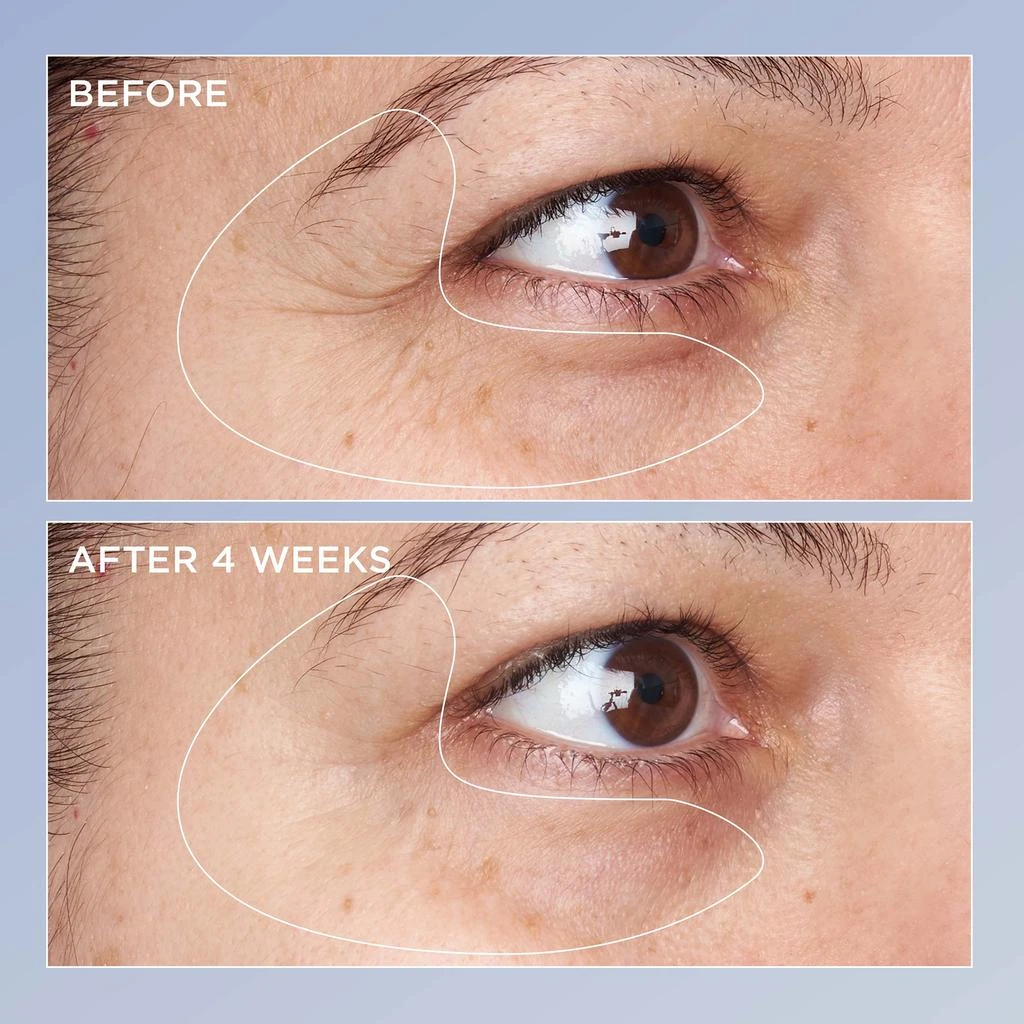 Perricone MD High Potency Triple Retinol Renewal Eye Serum 2