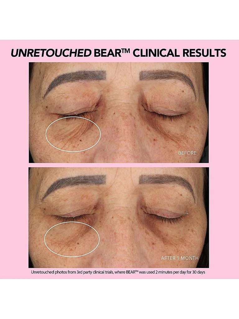 Foreo BEAR Smart Microcurrent Facial Toning Device 7