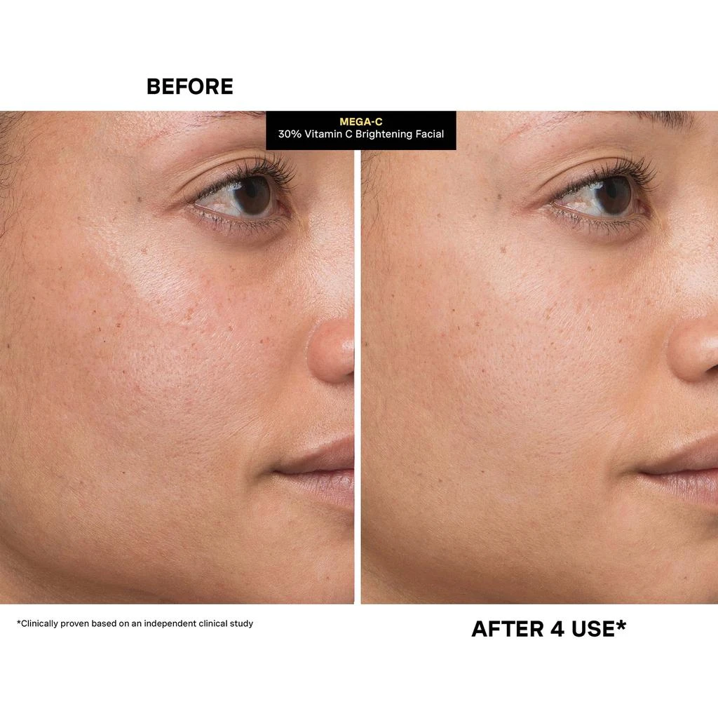 Kate Somerville Kate Somerville Mega-C 30% Vitamin C Brightening Facial 60ml 7