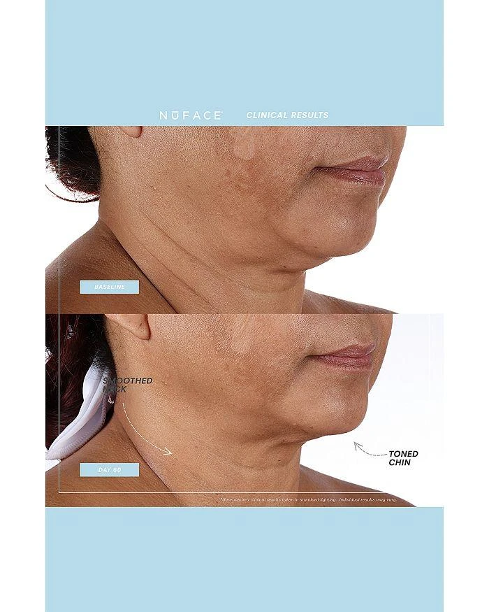 NuFace Mini+ Facial Toning Device & Primer - Black 7